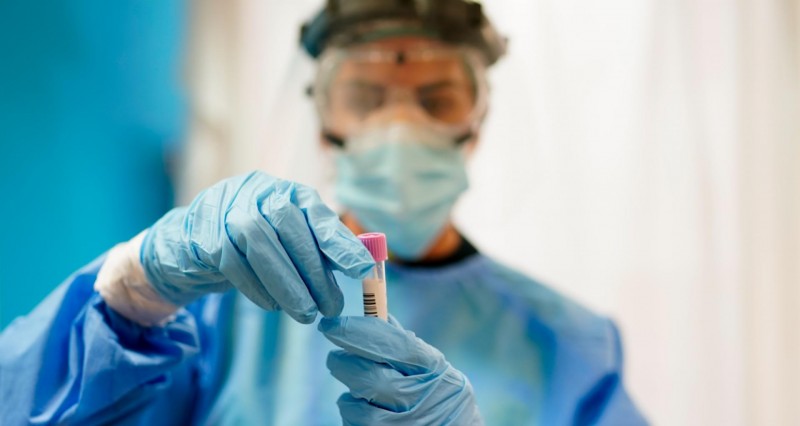 <span style='color:#780948'>ARCHIVED</span> - Under 2,000 Covid cases reported over the weekend in Andalusia: Covid update August 16